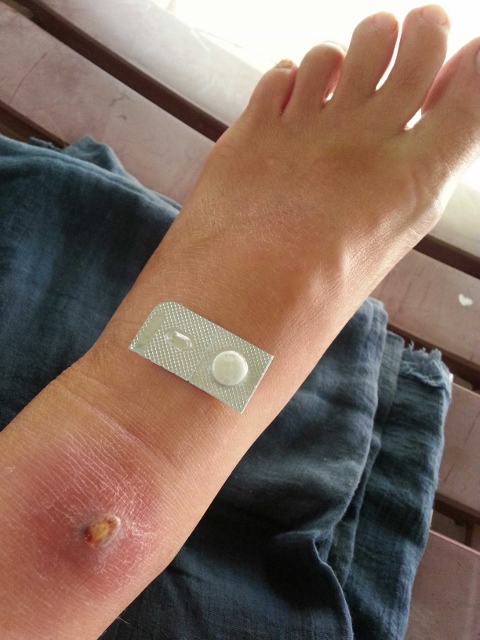 Beginning of the problem